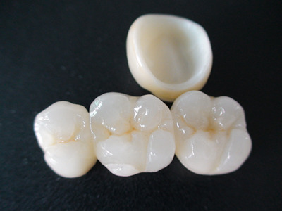 zirconium-dental-crowns-bridges-500x500.jpg zirconium-dental-crowns-bridges-500x500.jpg